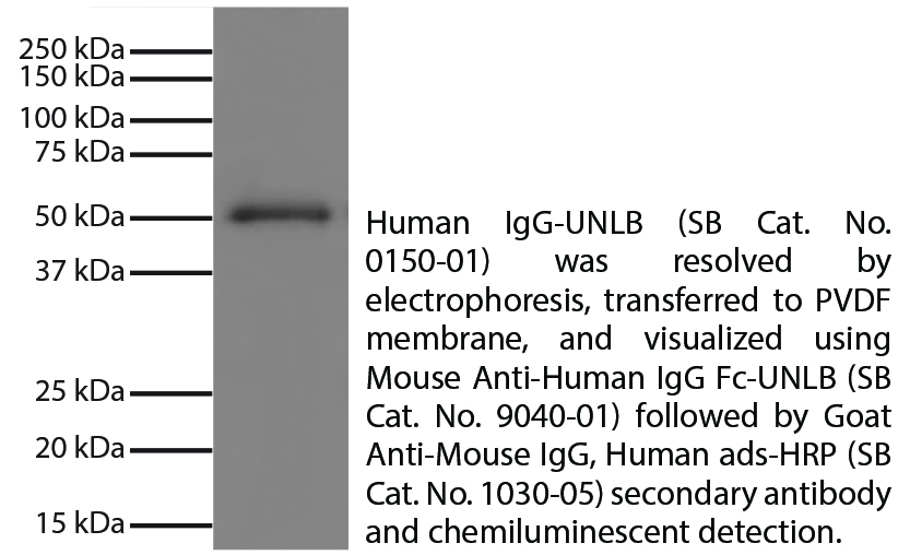 Human IgG-UNLB - 1.0 mg