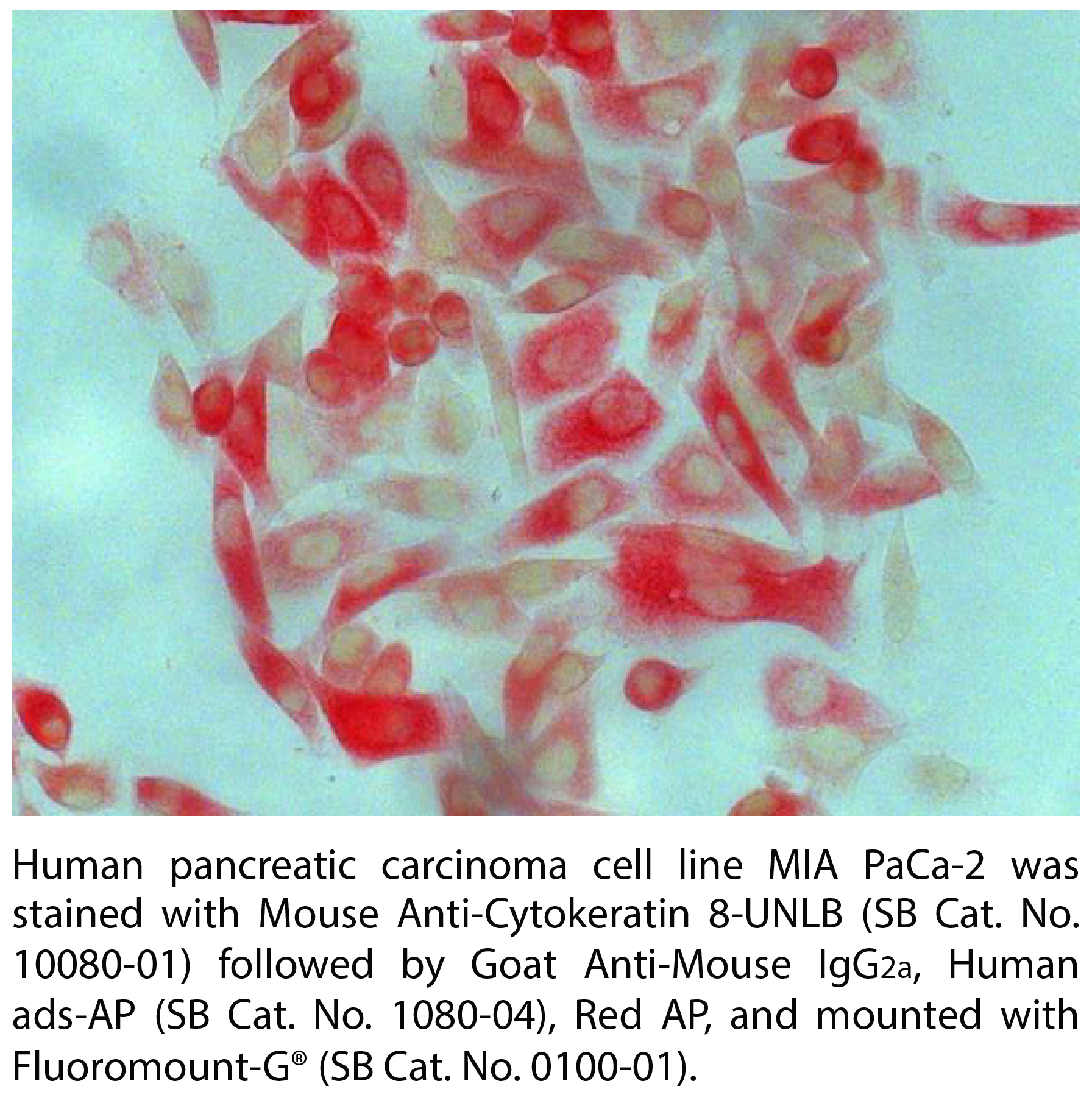 Mouse Anti-Cytokeratin 8-UNLB - 0.1 mg