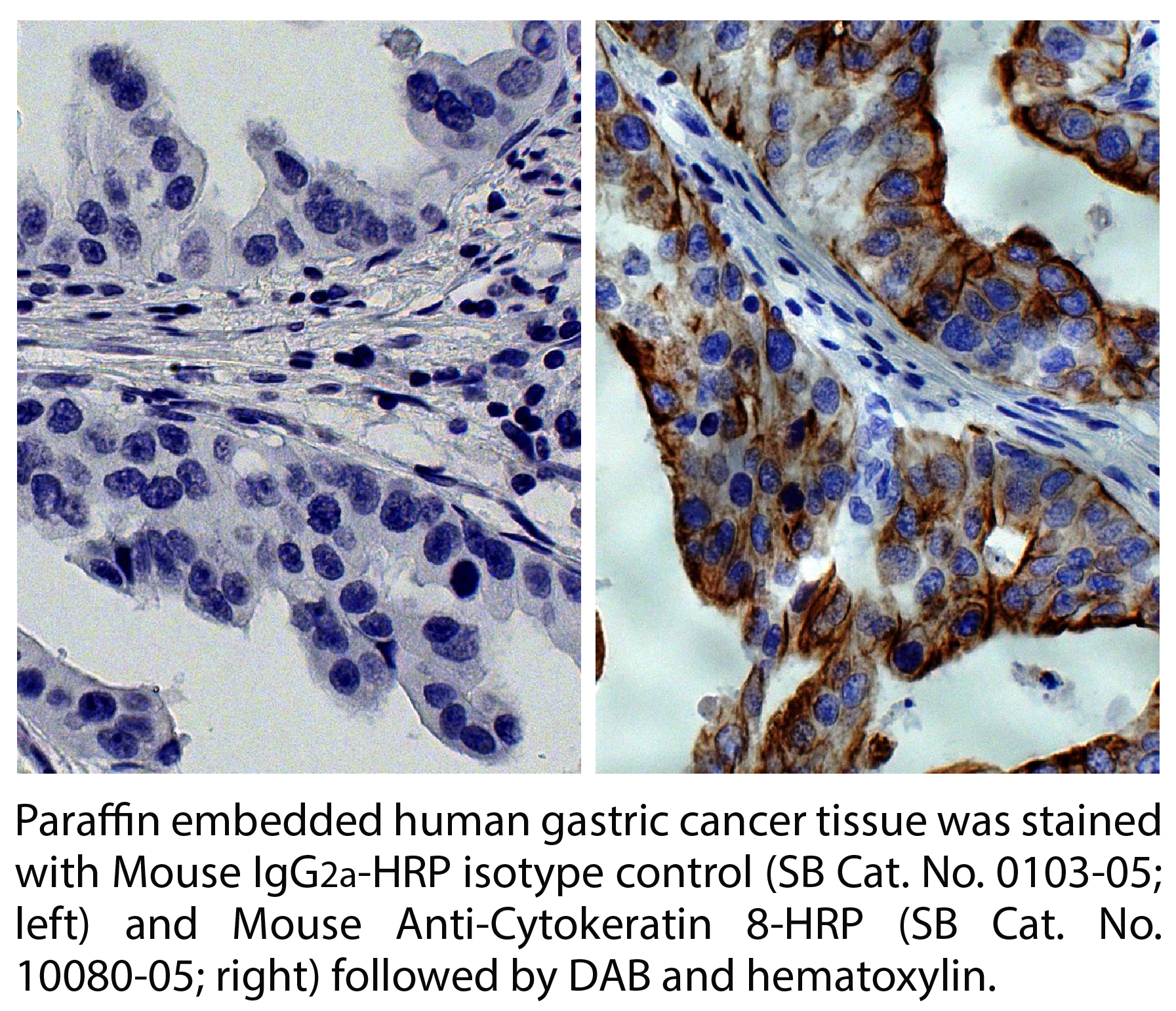 Mouse Anti-Cytokeratin 8-HRP - 1.0 mL