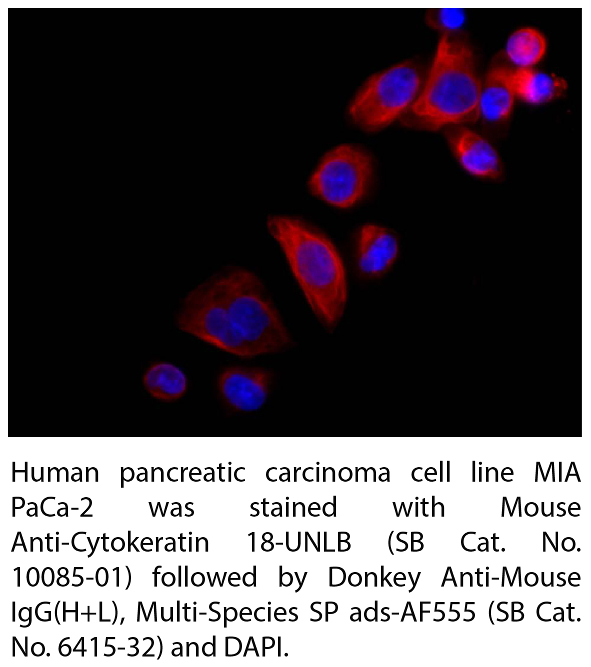 Mouse Anti-Cytokeratin 18-UNLB - 0.1 mg