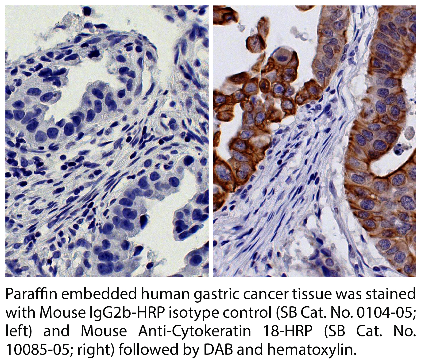 Mouse Anti-Cytokeratin 18-HRP - 1.0 mL