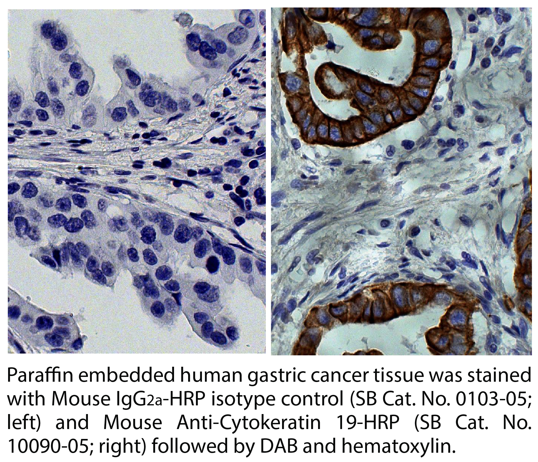 Mouse Anti-Cytokeratin 19-HRP - 1.0 mL