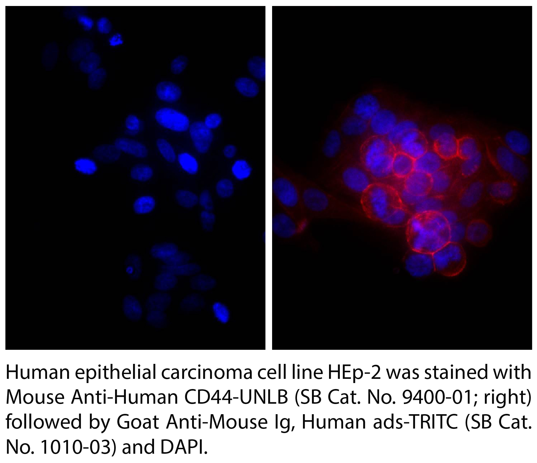 Goat Anti-Mouse Ig, Human ads-TRITC - 1.0 mg