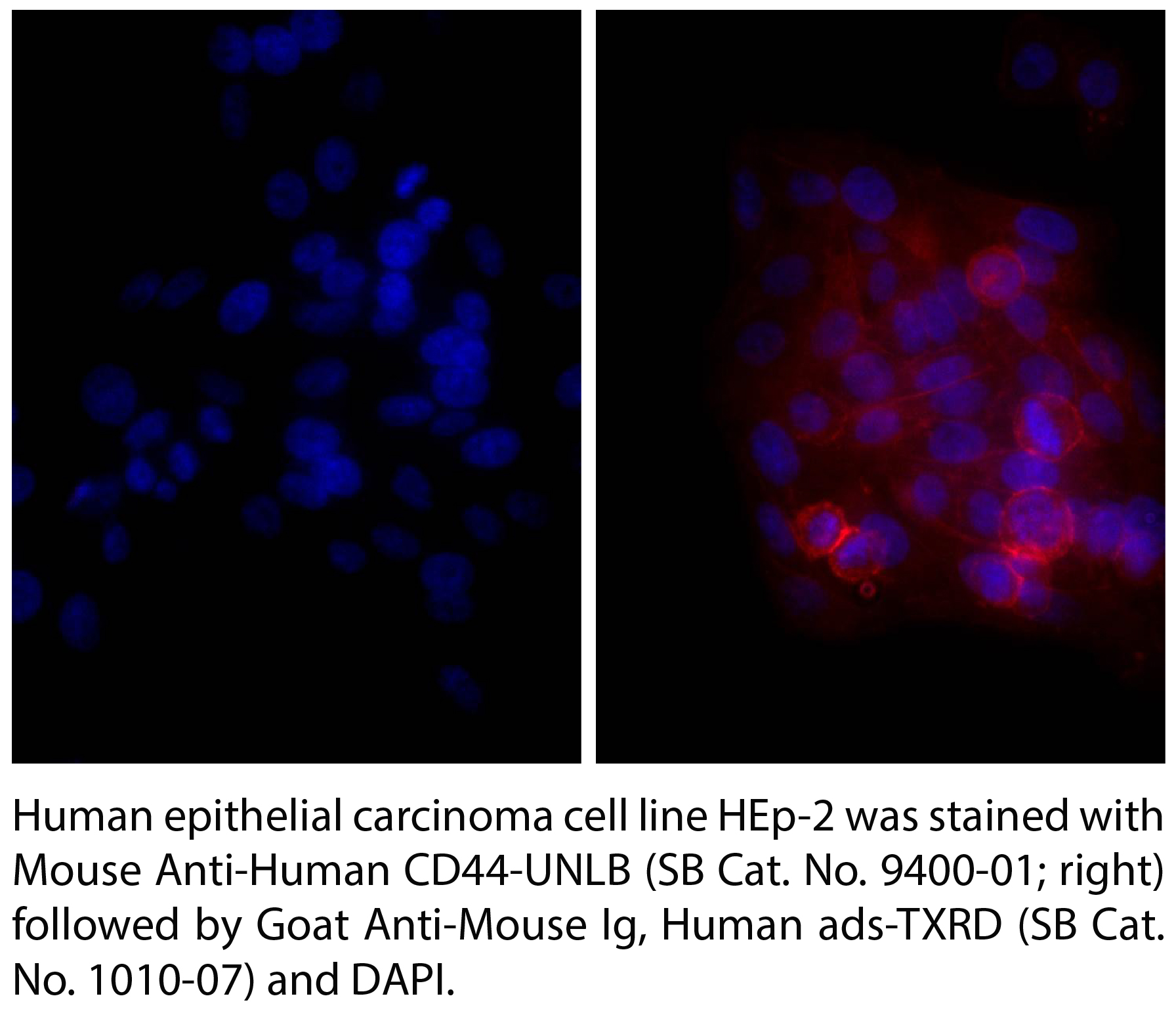 Goat Anti-Mouse Ig, Human ads-TXRD - 1.0 mg