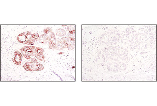 Phospho-Jak Family Antibody Sampler Kit - 1 Kit