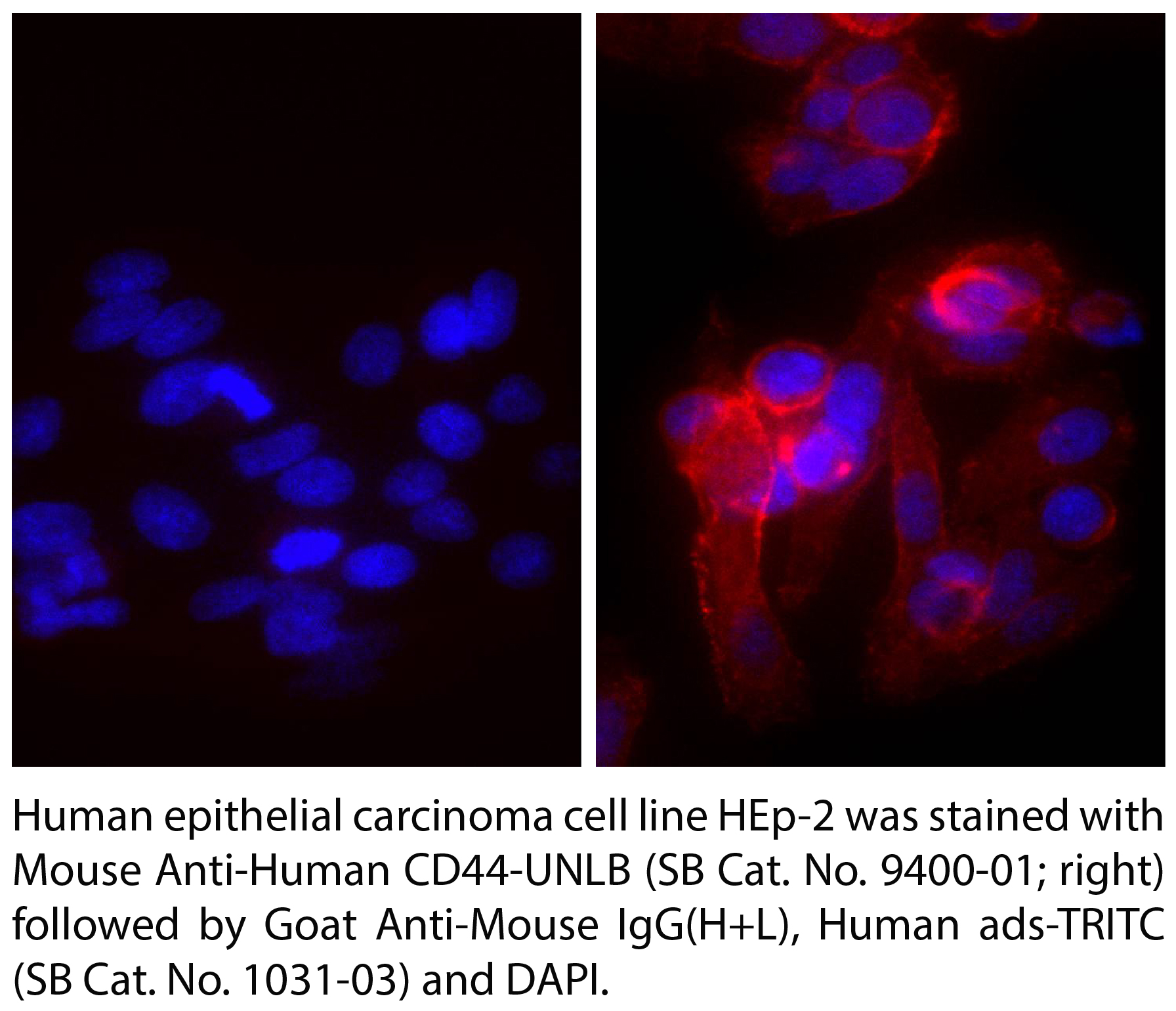 Goat Anti-Mouse IgG(H+L), Human ads-TRITC - 1.0 mg