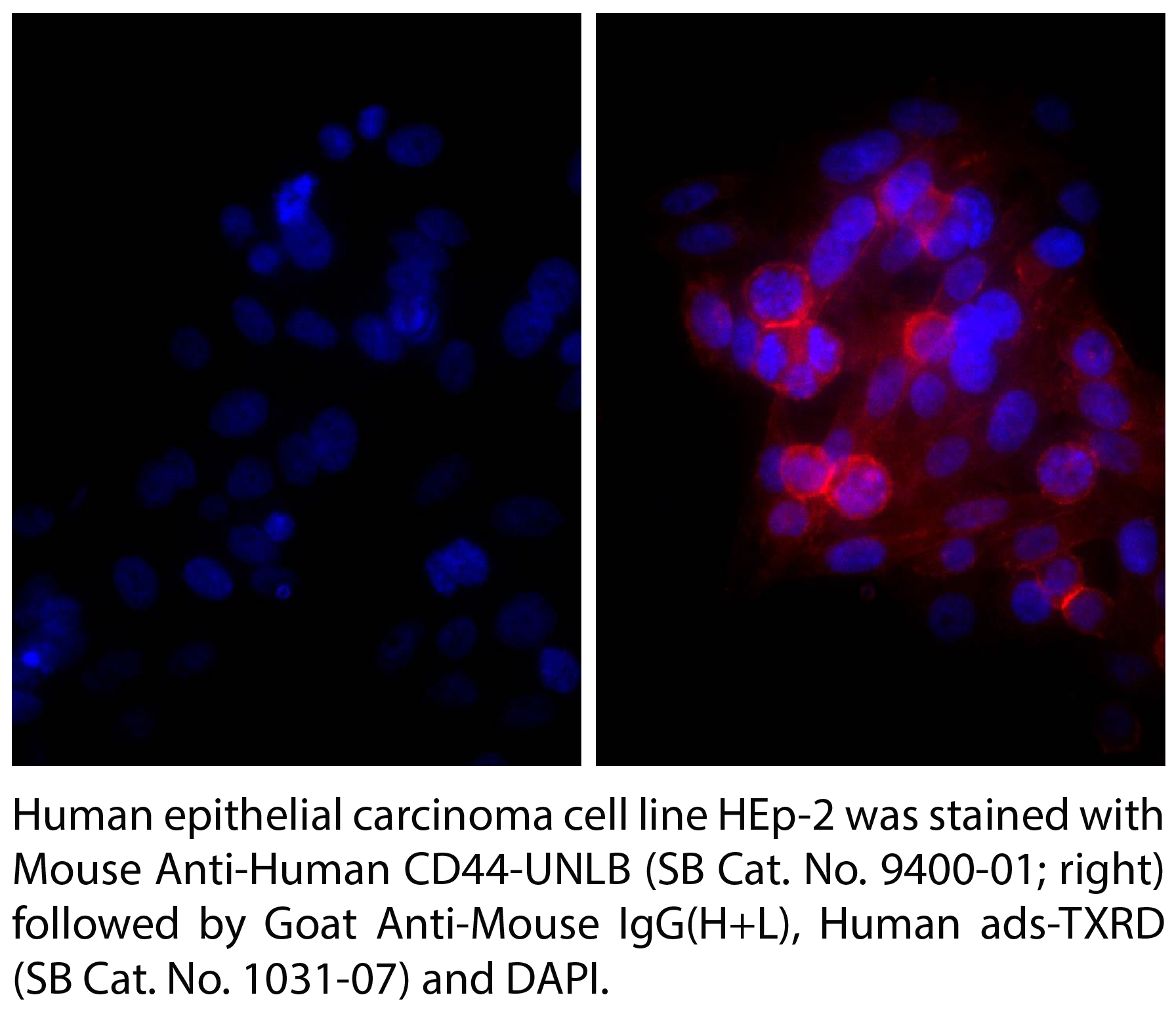 Goat Anti-Mouse IgG(H+L), Human ads-TXRD - 1.0 mg