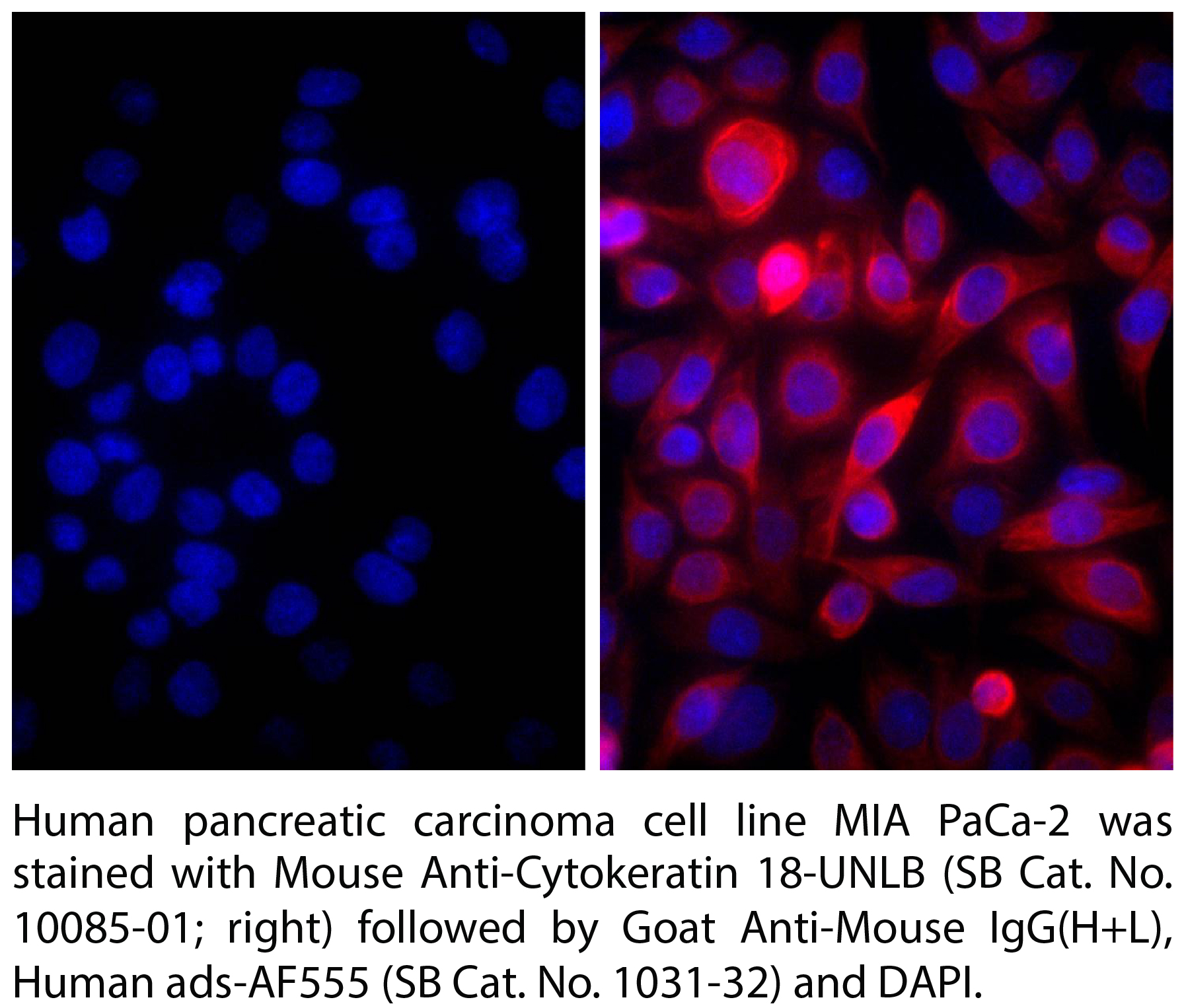 Goat Anti-Mouse IgG(H+L), Human ads-AF555 - 1.0 mg