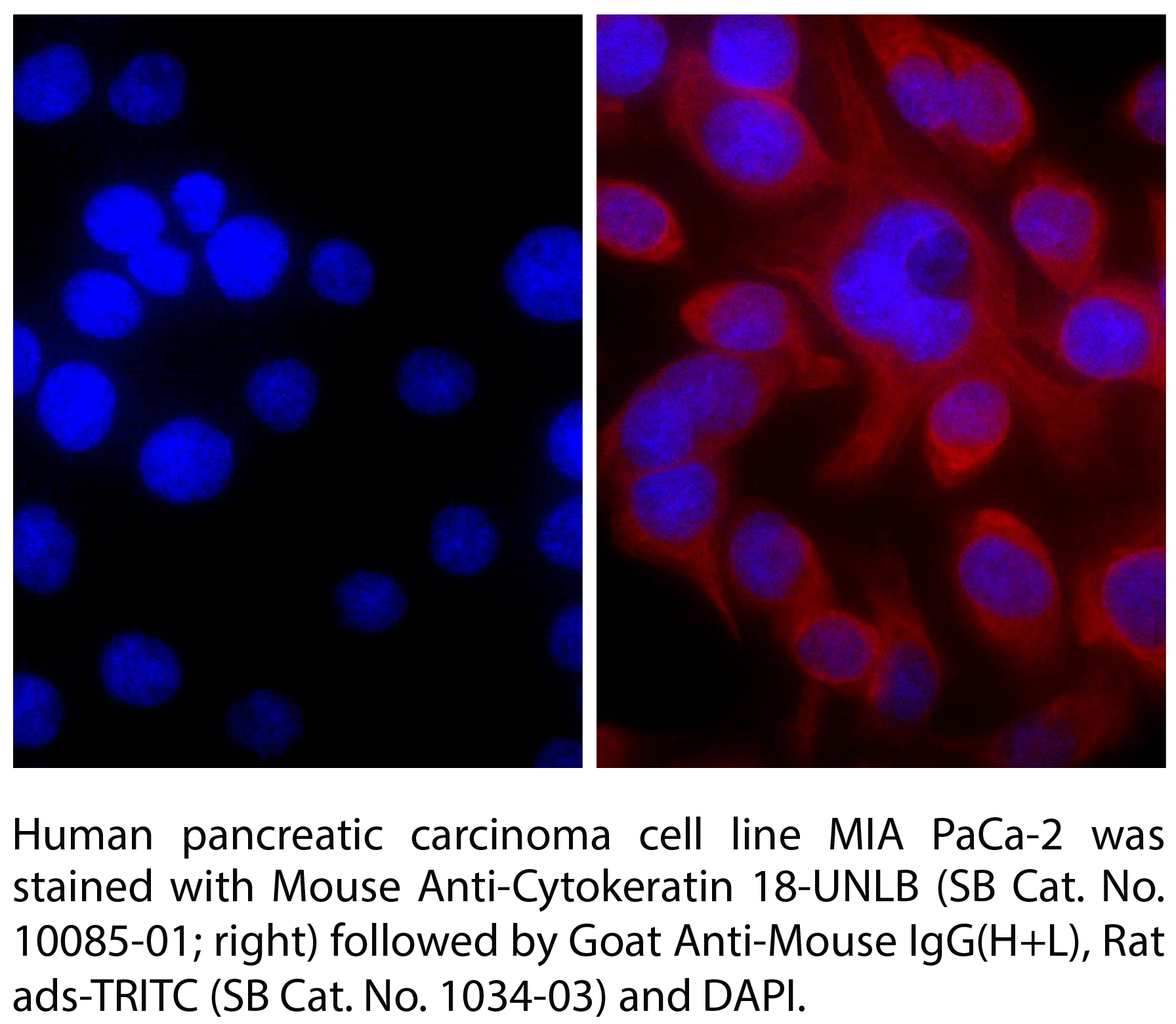 Goat Anti-Mouse IgG(H+L), Rat ads-TRITC - 0.5 mg