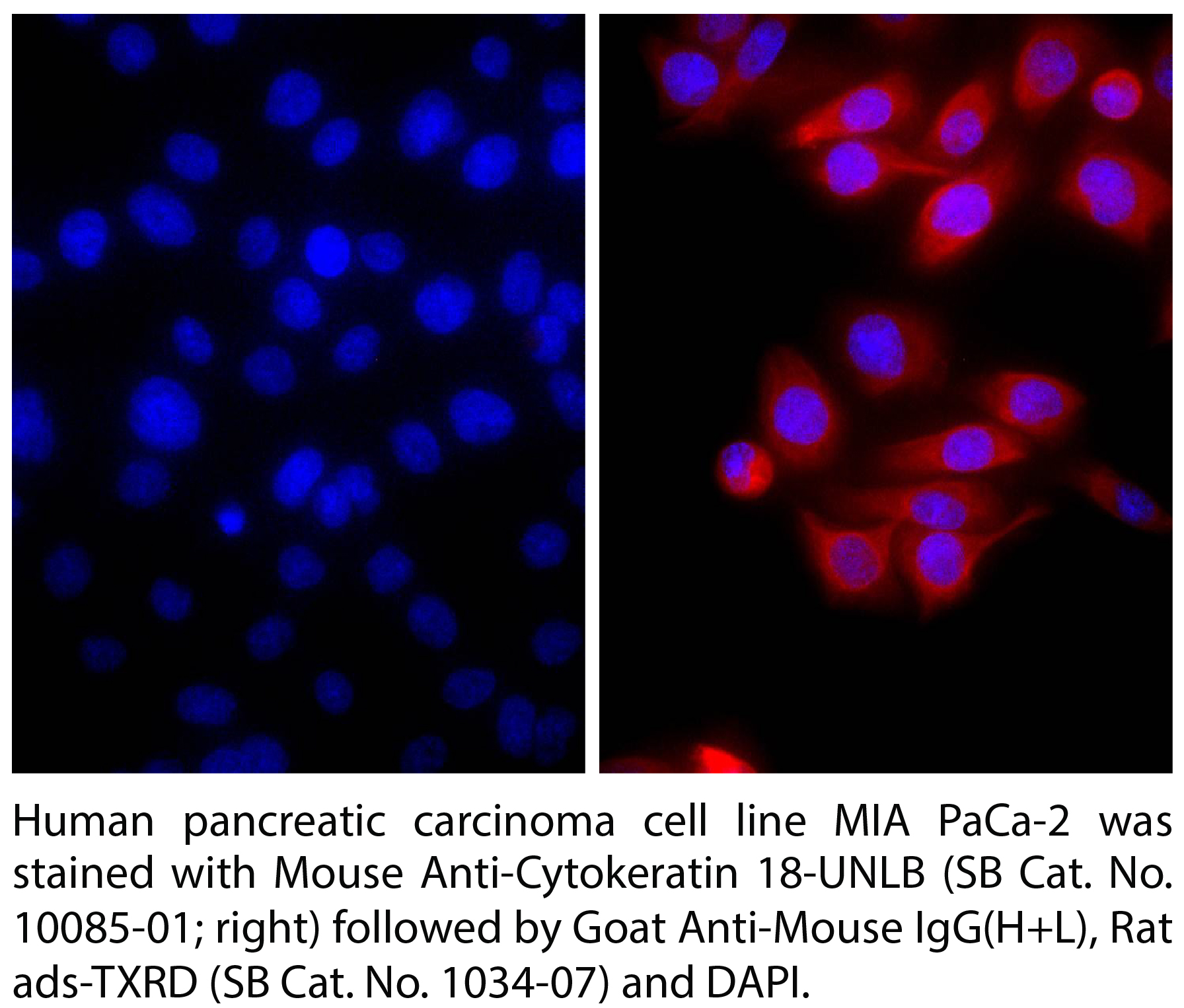 Goat Anti-Mouse IgG(H+L), Rat ads-TXRD - 0.5 mg