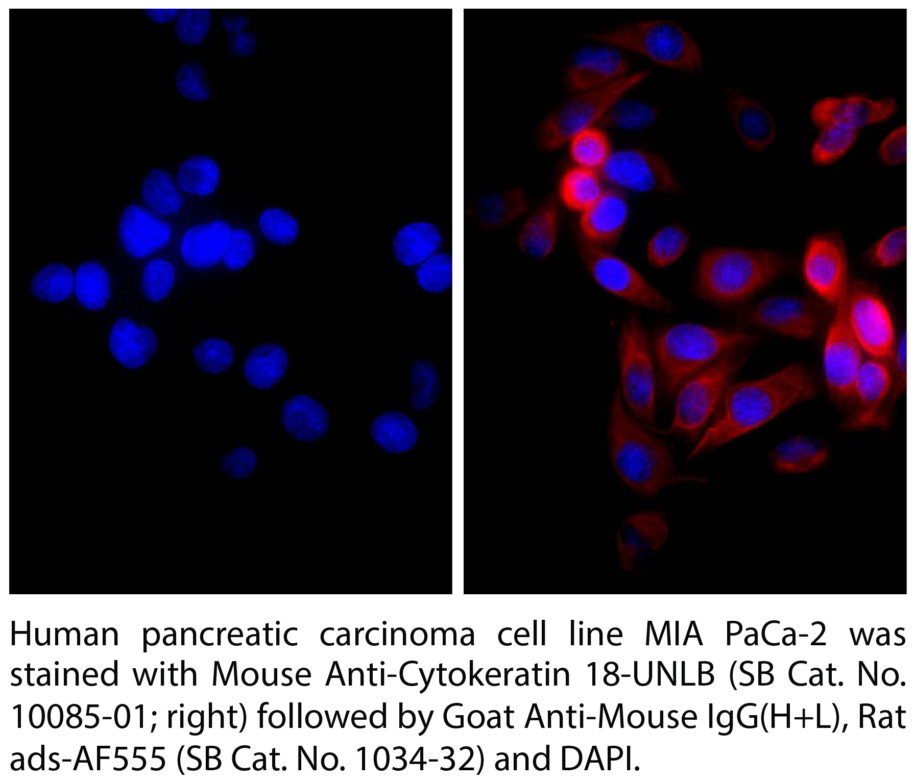 Goat Anti-Mouse IgG(H+L), Rat ads-AF555 - 0.5 mg