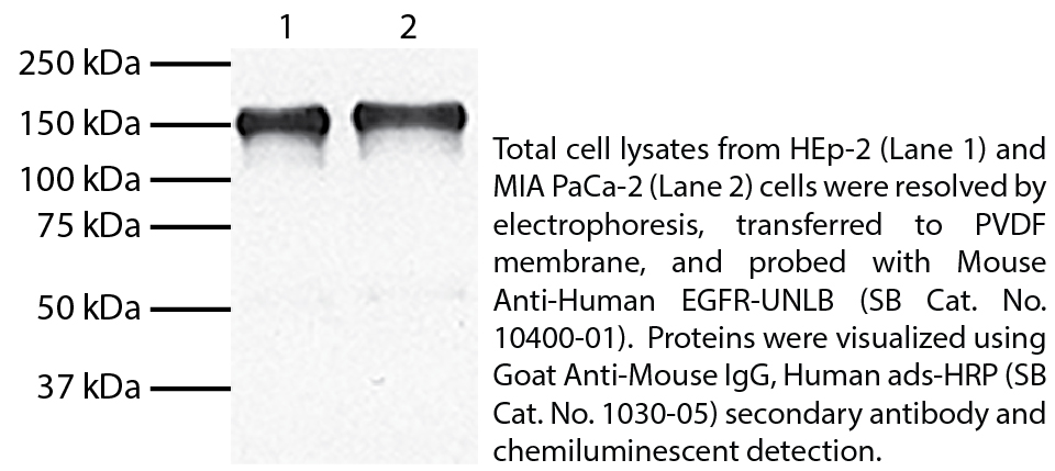 Mouse Anti-Human EGFR-UNLB - 0.1 mg