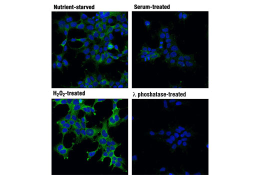 Acetyl-CoA Carboxylase 1 and 2 Antibody Sampler Kit - 1 Kit