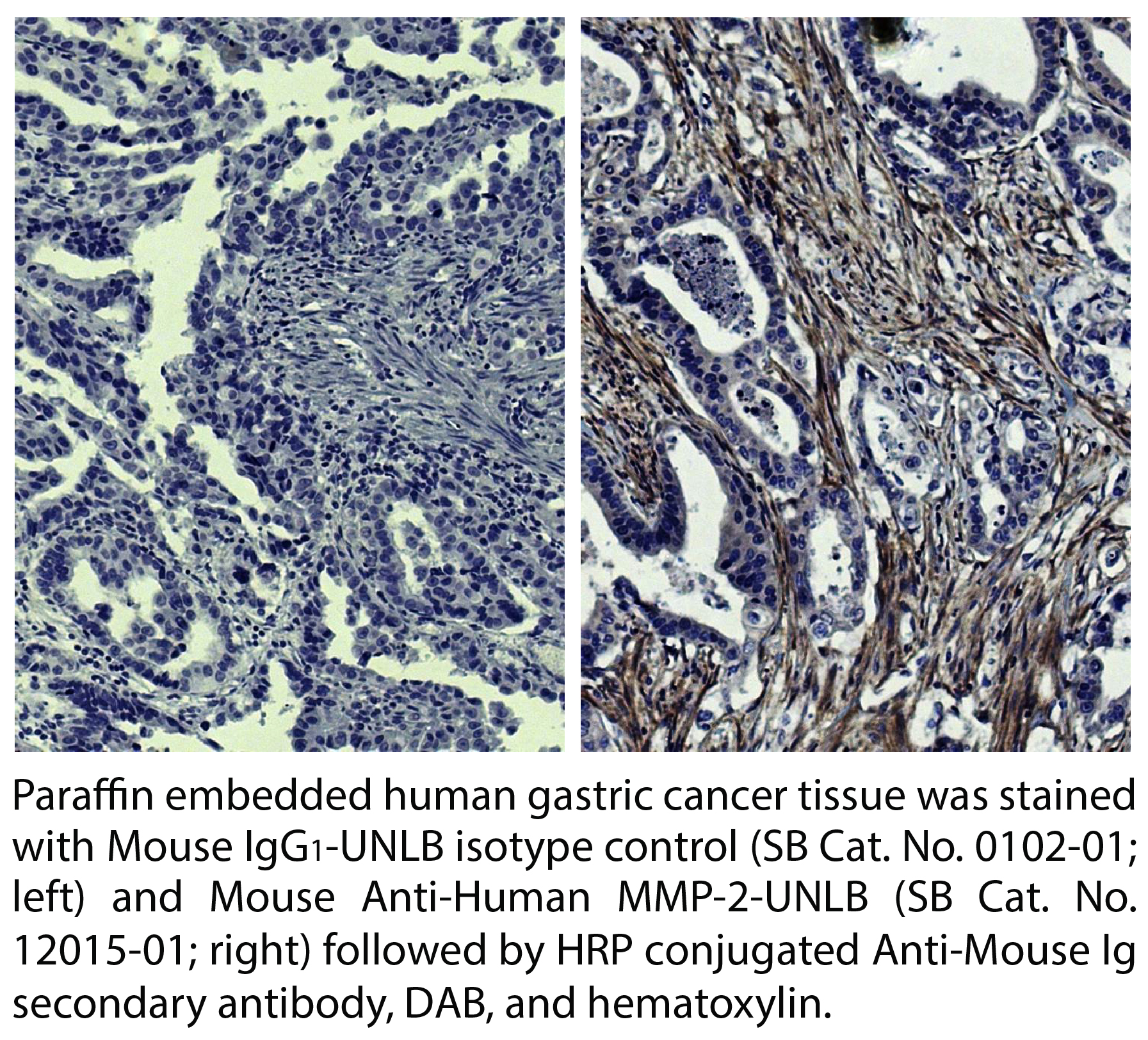 Mouse Anti-Human MMP-2-UNLB - 0.1 mg