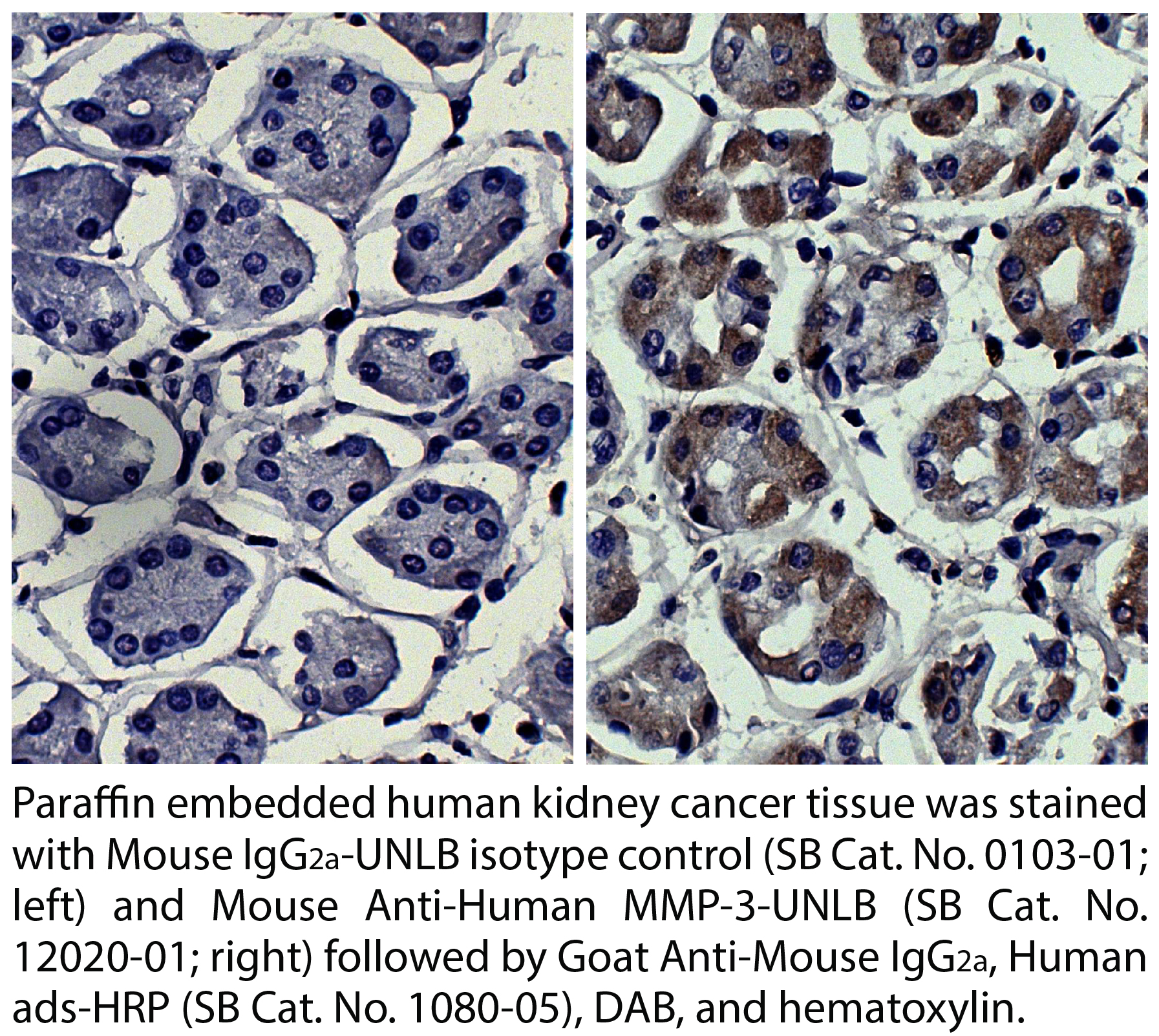 Mouse Anti-Human MMP-3-UNLB - 0.1 mg