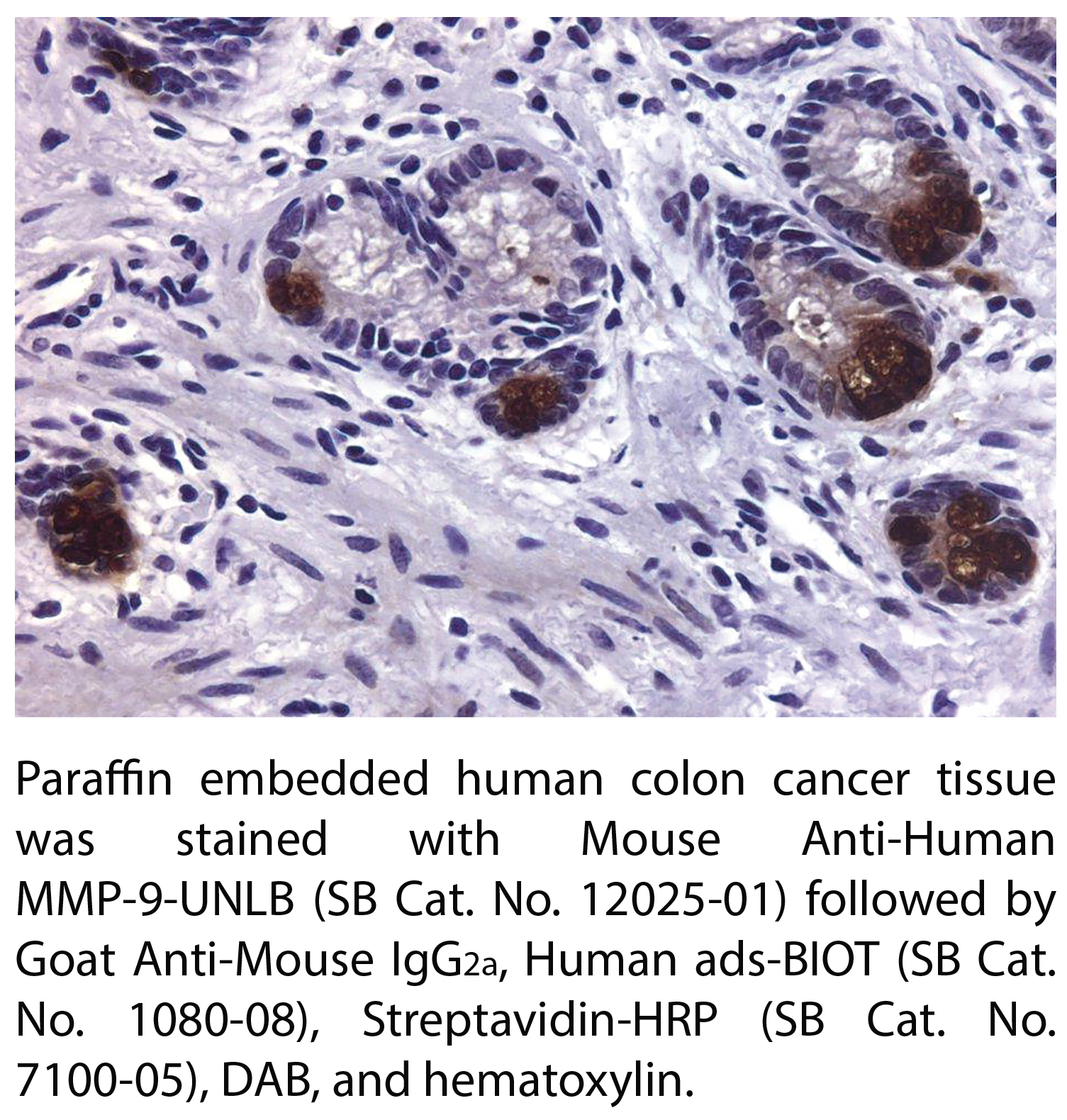 Mouse Anti-Human MMP-9-UNLB - 0.1 mg