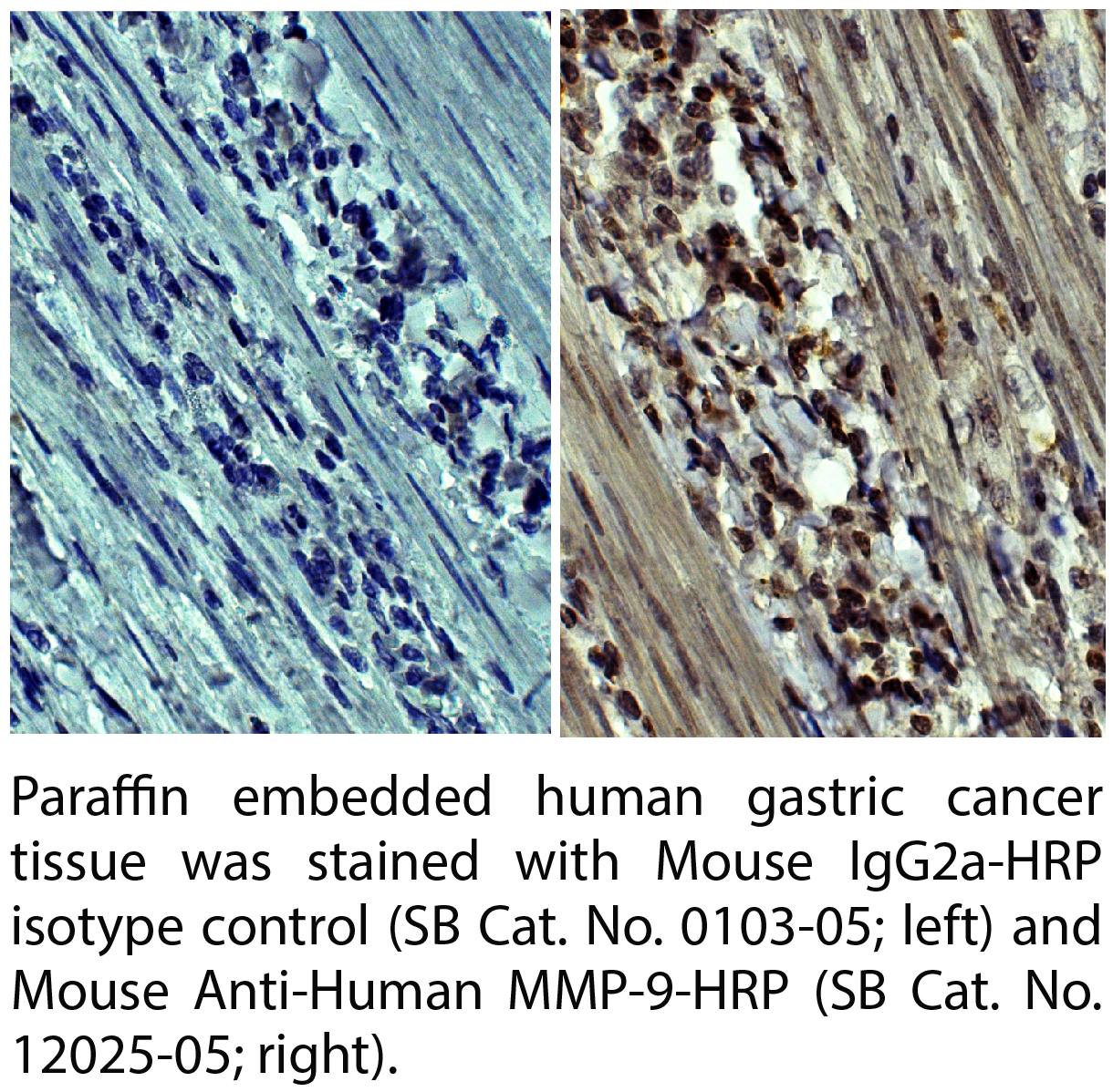 Mouse Anti-Human MMP-9-HRP - 1.0 mL