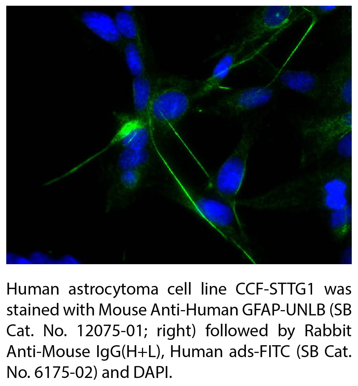 Mouse Anti-Human GFAP-UNLB - 0.5 mg