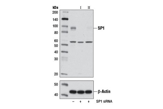 SignalSilence® SP1 siRNA II - 300 ul