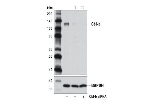 SignalSilence® Cbl-b siRNA I - 300 ul