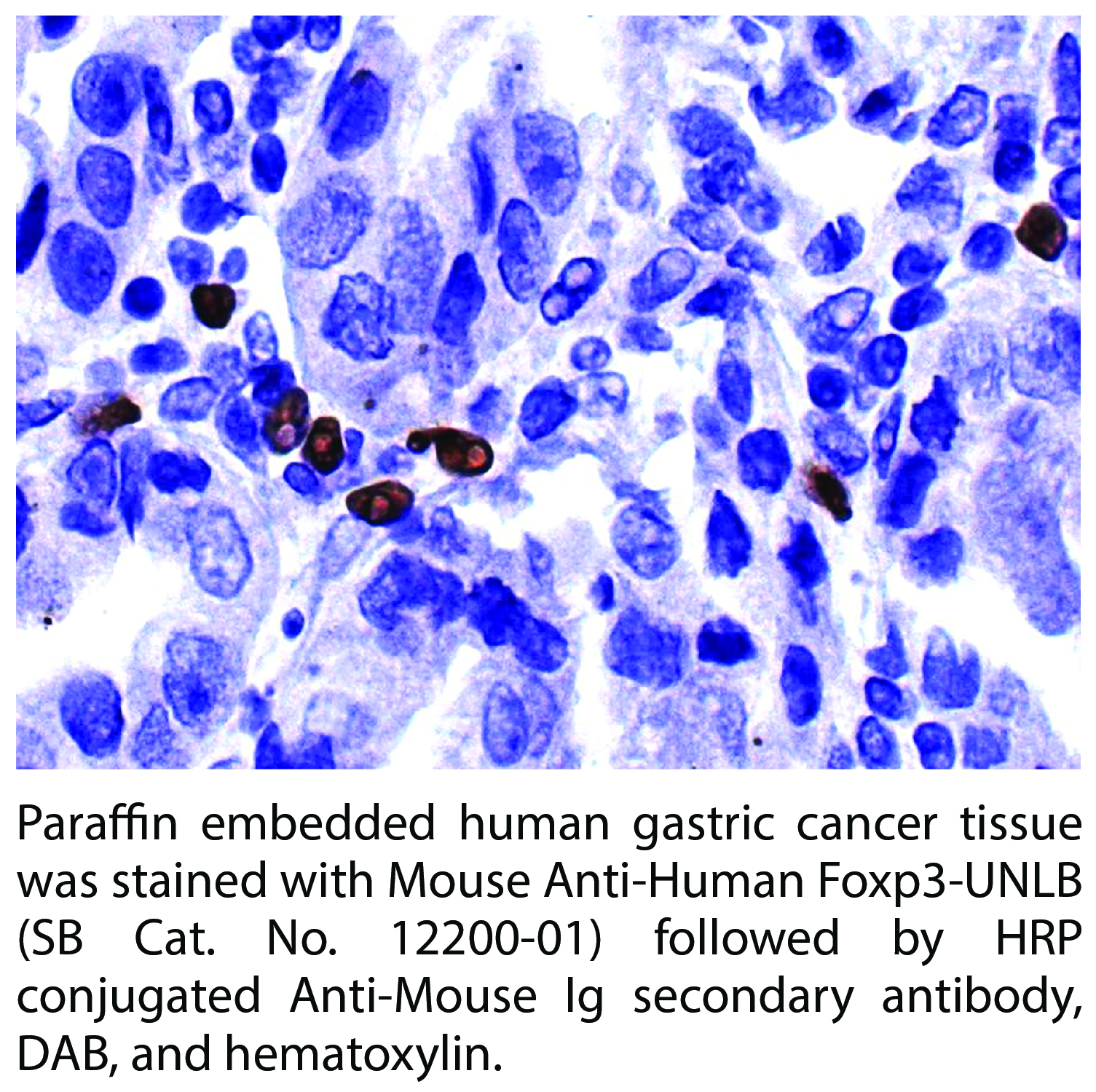 Mouse Anti-Human Foxp3-UNLB - 0.1 mg