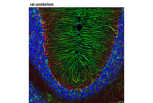 Neuronal Marker IF Antibody Sampler Kit - 1 Kit