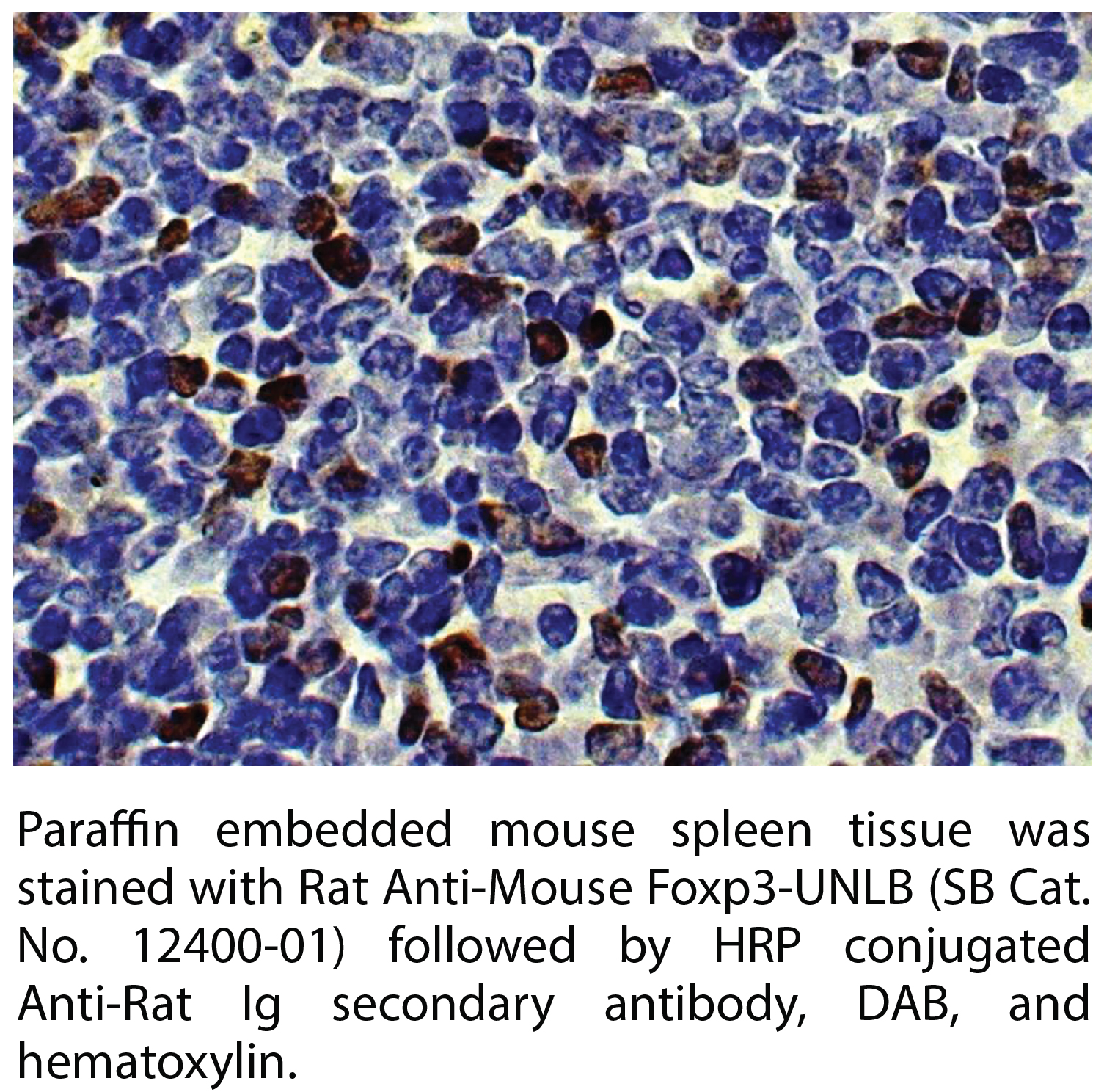 Rat Anti-Mouse Foxp3-UNLB - 0.1 mg