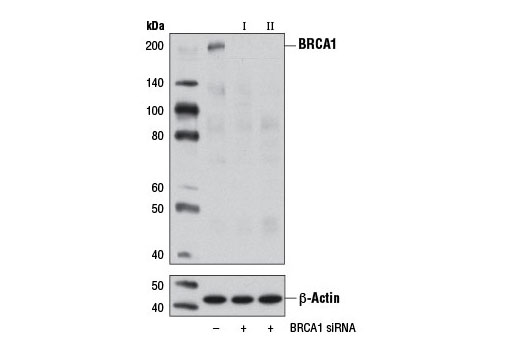 SignalSilence® BRCA1 siRNA I - 300 ul