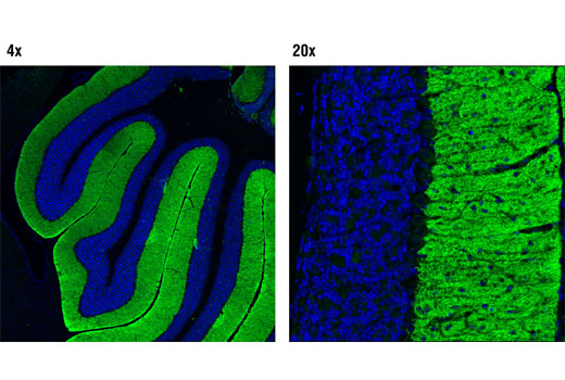 Fragile X/FMRP Signaling Pathway Antibody Sampler Kit - 1 Kit