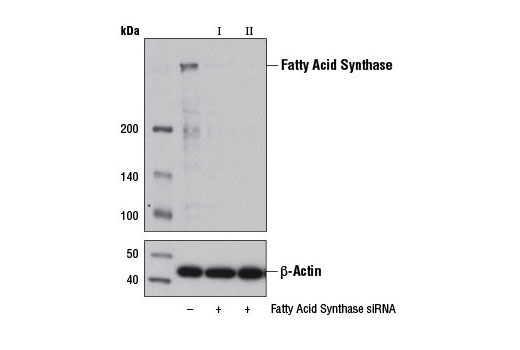 SignalSilence® Fatty Acid Synthase siRNA II - 300 ul