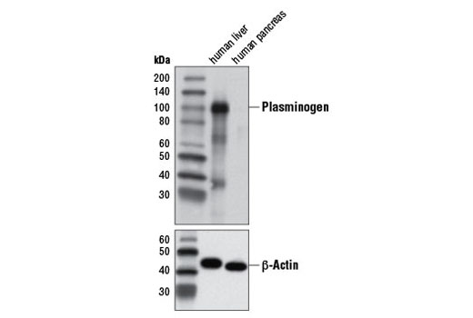 Plasminogen Antibody - 100 ul