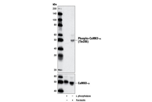 PhosphoPlus® CaMKII (Thr286) Antibody Duet - 1 Kit