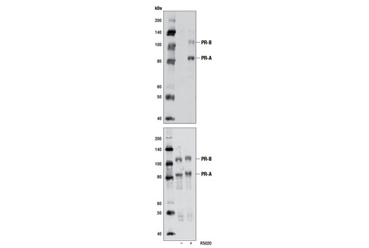 Phospho-Progesterone Receptor (Ser345) Antibody - 100 ul