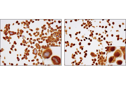 SignalSlide® NF-κB p65 IHC Controls - 1 Pack