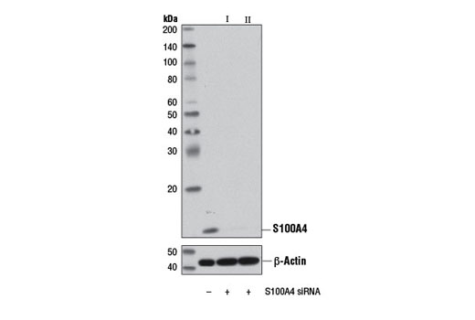 SignalSilence® S100A4 siRNA I - 300 ul