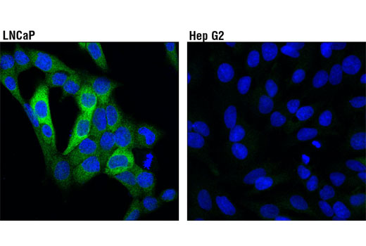 PhosphoPlus® PFKFB2 (Ser483) Antibody Duet - 1 Kit