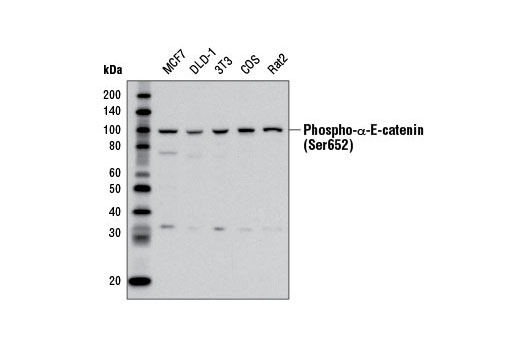 Phospho-α-E-Catenin (Ser652) Antibody - 100 ul