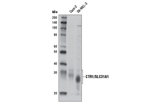 CTR1/SLC31A1 Antibody - 100 ul