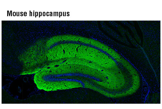 Silent Synapses Antibody Sampler Kit - 1 Kit