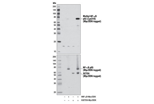 Methyl-NF-κB p65 (Lys310) Antibody - 100 ul