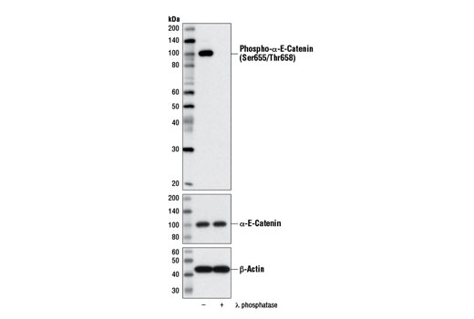 Phospho-α-E-Catenin (Ser655/Thr658) Antibody - 100 ul