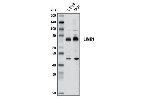 LIMD1 Antibody - 100 ul