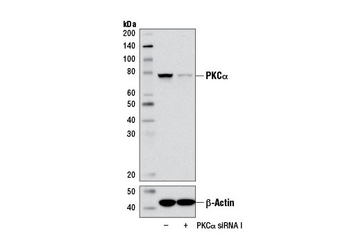 SignalSilence® PKCα siRNA I - 300 ul