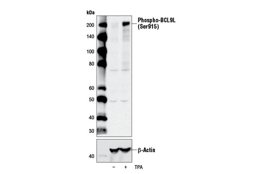 Phospho-BCL9L (Ser915) Antibody - 100 ul