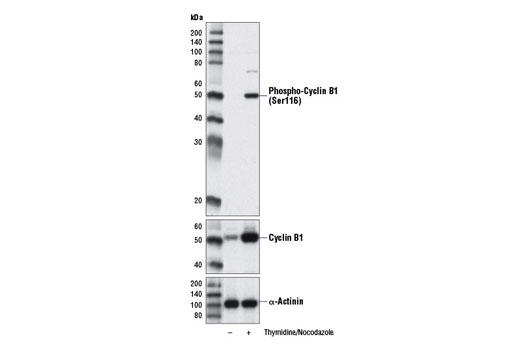 Phospho-Cyclin B1 (Ser116) Antibody - 100 ul