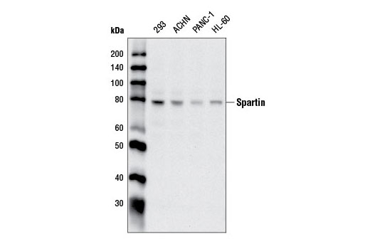 Spartin Antibody - 100 ul