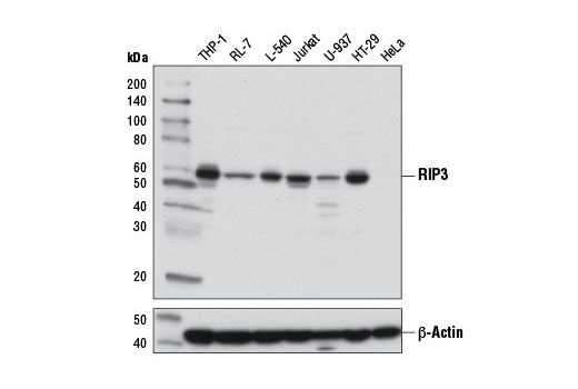 PhosphoPlus® RIP3 (Ser227) Antibody Duet - 1 Kit