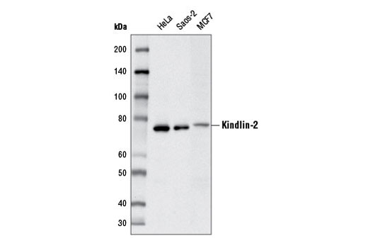 Kindlin-2 Antibody - 100 ul