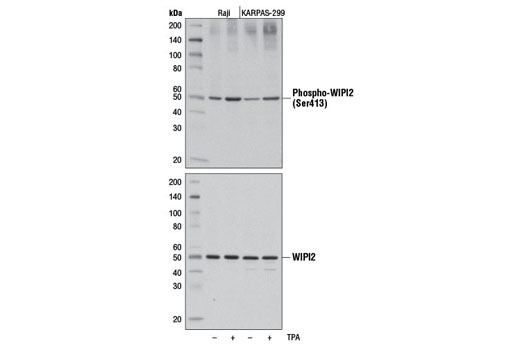 Phospho-WIPI2 (Ser413) Antibody - 100 ul