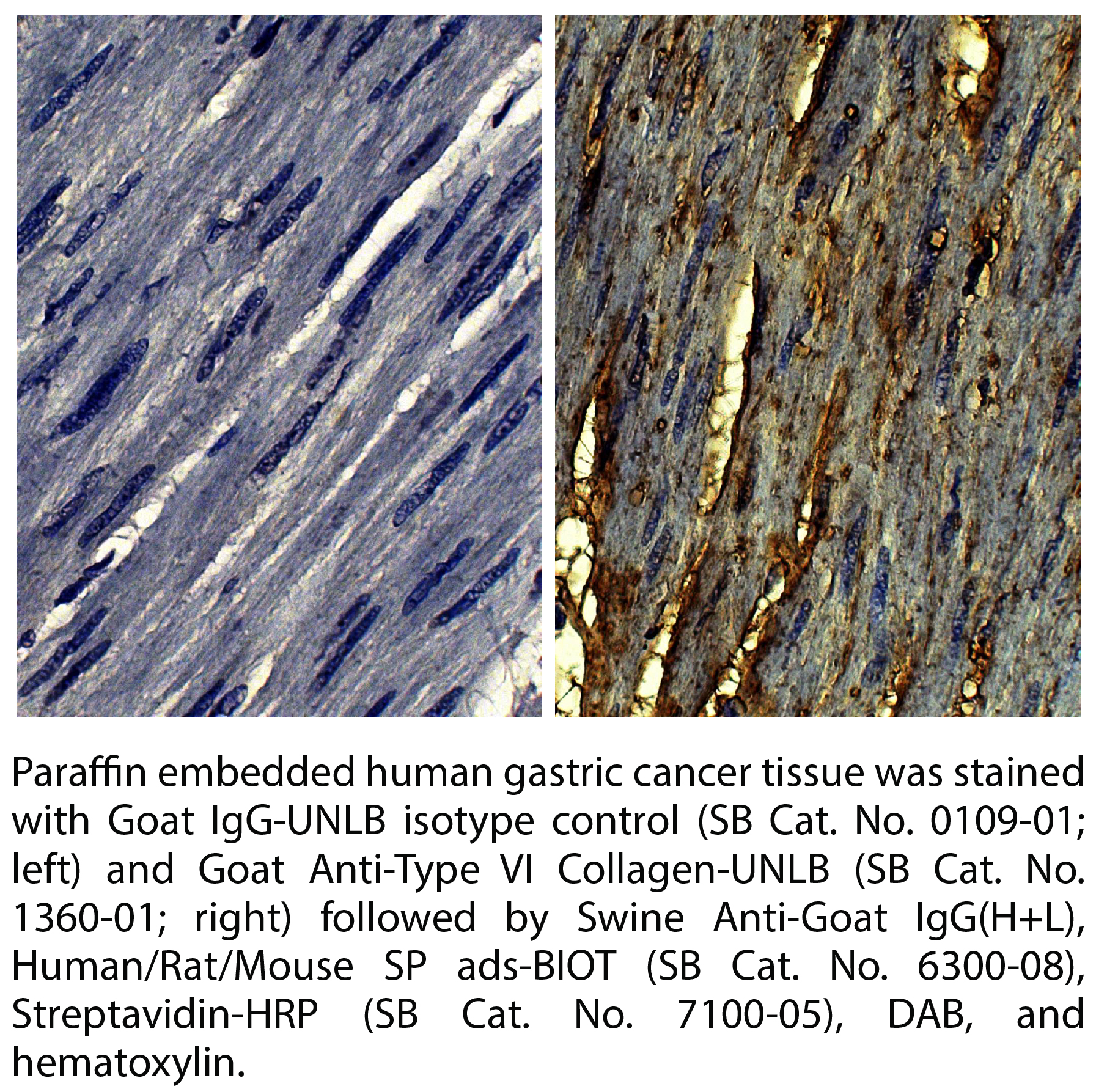 Goat Anti-Type VI Collagen-UNLB - 0.2 mg